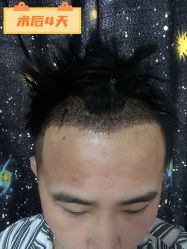 -雍禾植发全国连锁