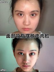 -上海时光整形外科医院