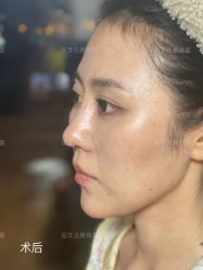 -北京米扬丽格医疗美容·联合丽格鼻整形中心