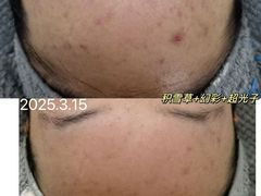 -上置·美兰优湖