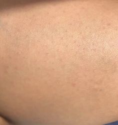 体验后-丽都整形美容医院·全国连锁旗舰店