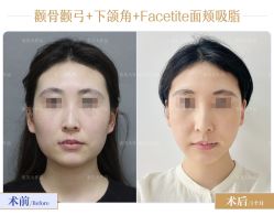 -圣嘉新医疗美容医院