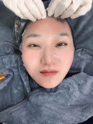 体验前-素妍医疗美容抗衰中心