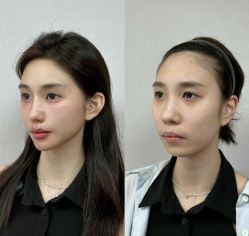 -宁波美莱整形美容