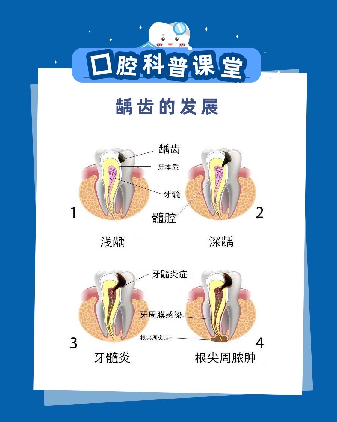 龋齿的形成过程图片图片