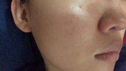 体验后-圣嘉新医疗美容医院