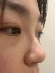 体验后-上海玫瑰医疗美容医院