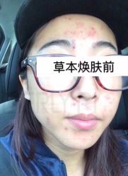 -MLP美丽派·问题肌疗愈中心