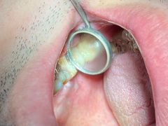 -微笑牙科口腔(三亚迎宾院区)