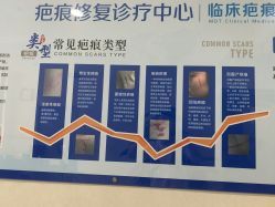 -成都军建医院·疤痕诊疗中心