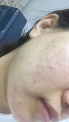 -荟草堂痘肌修护中心
