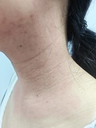 -长沙雅美医疗美容医院
