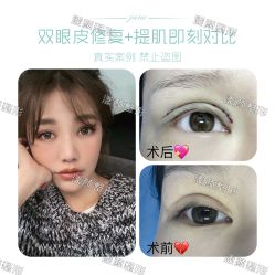 -上海漾颜医疗美容