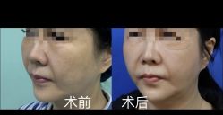 -上海华美医疗美容医院
