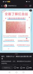 点击看大图 -凡碧诗毛孔清洁收细