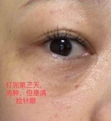 体验后-深圳广和门诊部·整形医疗美容