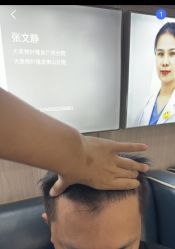 -大麦微针植发全国连锁