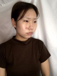 -成都军建医院·疤痕诊疗中心