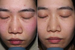 -Cream88颜皮肤管理中心