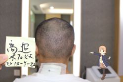 -大麦微针植发丨全国连锁