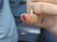 -北京市垂杨柳医院