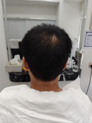 -唐风采假发补发定制