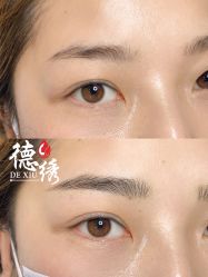 -德绣·机器野生眉发际线·美瞳线半永久