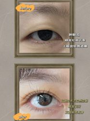 -素美医疗美容·西南眼鼻整形·修复基地