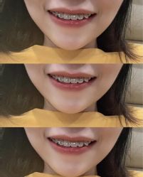 -安徽合肥韩美整形外科医院