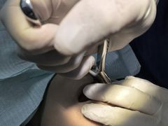 -天使口腔门诊部(上海店)