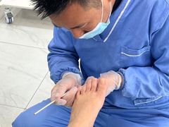 -Andrew指甲专科灰指甲·甲沟炎矫正·3D步态矫形鞋垫定制(浦三路店)