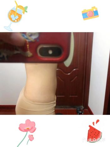 产后腰疼终于找到了原因Ⅰ骨盆修复一定要重视！！！