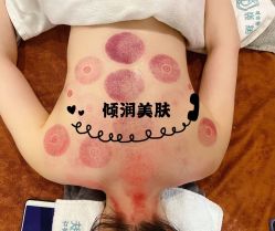 -倾润皮肤管理
