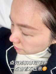 -清疣美疣·痣·斑净肤中心