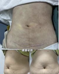 -郡艺医疗美容·微整·眼鼻吸脂