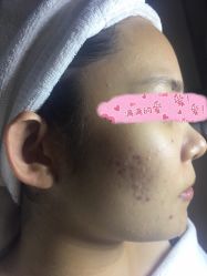 -皇族养心堂·净痘·修敏·御颜