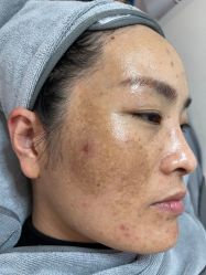 -+MS卓美丝专业祛痘·皮肤管理中心