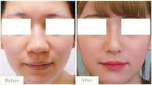 -SKINIST丽铂医疗美容