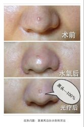 脸部抗衰-光SPA科技美肤