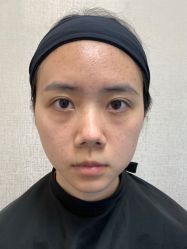 -广州健丽·去眼袋医疗美容机构