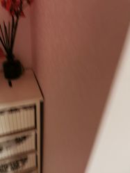 -薇兰专业脱毛连锁机构