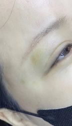 -德绣·机器野生眉发际线·美瞳线半永久