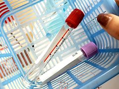 -悦检(中山大学孙逸仙纪念医院体检中心)