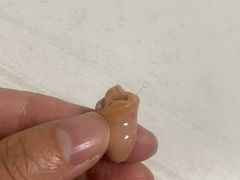 -宁耳听力助听器奥迪康峰力西门子斯达克(静安闸北店)