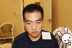 点击看大图 -大麦微针植发丨全国连锁