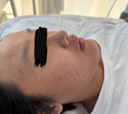 -荟草堂专业祛痘修护中心