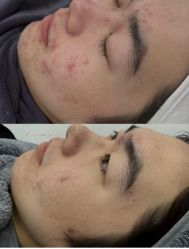 -SOS修丽可.痘肌修复中心