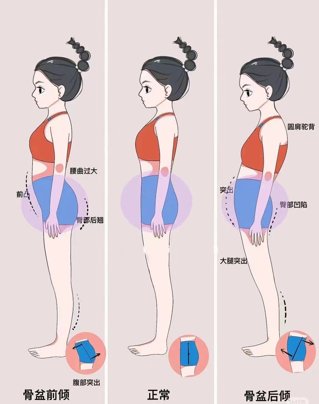 整个腹部的位置偏离了身体的中线.图二