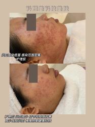 -美肤盾祛痘·问题肌头疗管理中心