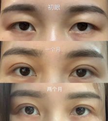 体验前-西安壹加壹医疗美容·西北抗衰旗舰店